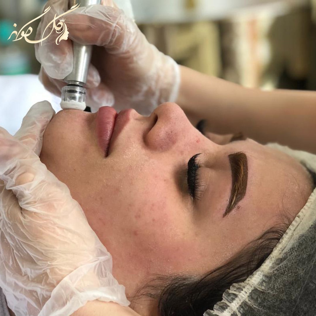 golgoonehbeauty